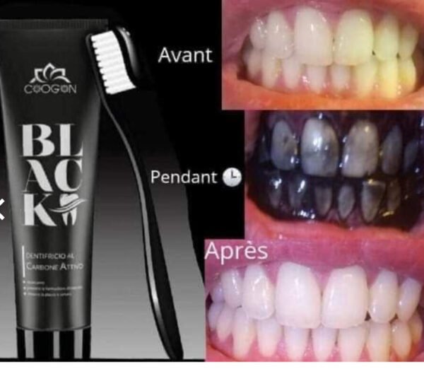 Dentifrice Dents Blanchissant au charbon actif 115G